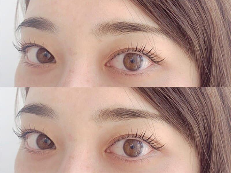 Noa