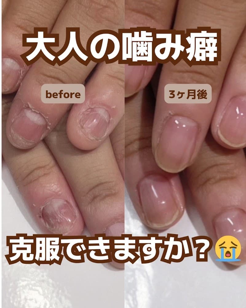 ネイルサロンキャメロット【深爪矯正専門店】池袋店