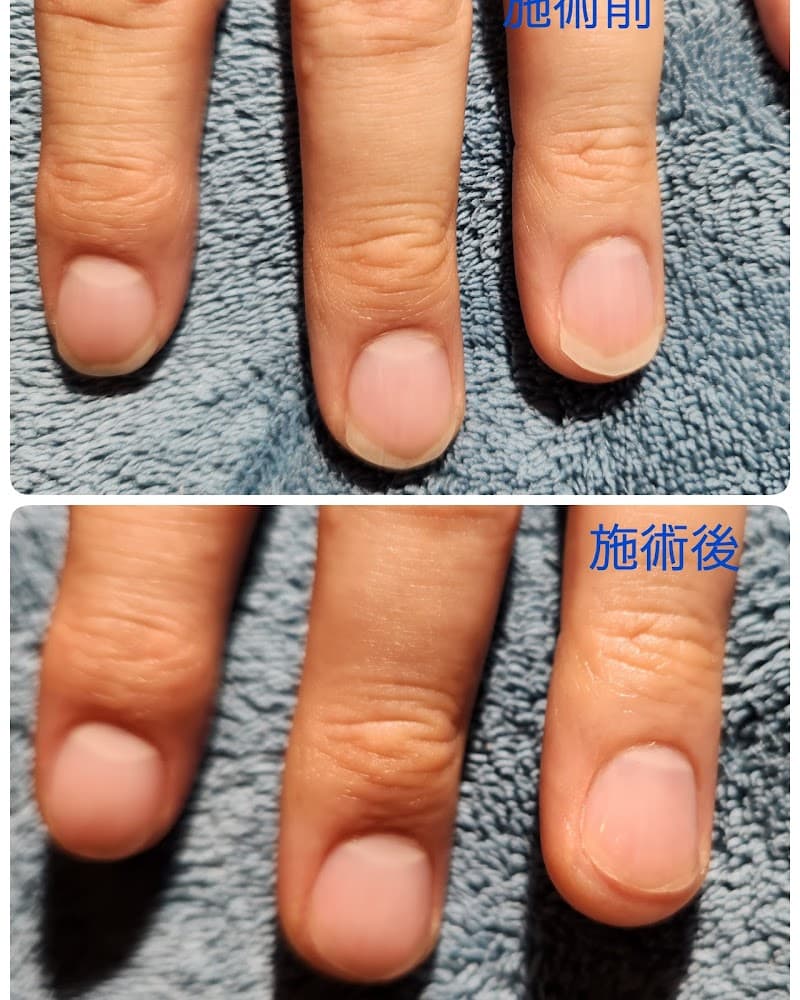 ダンディネイル