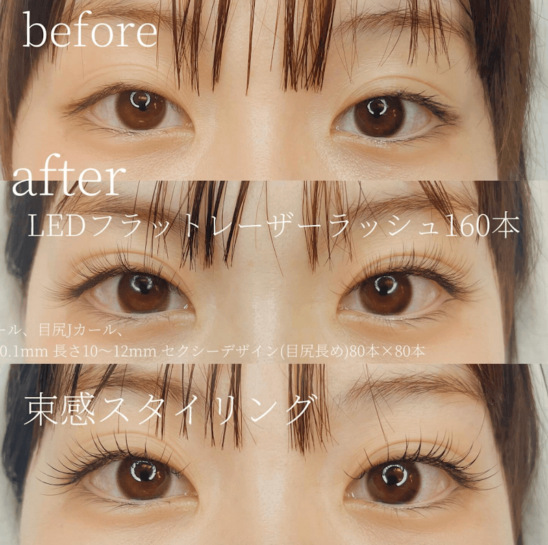 comachieyelash