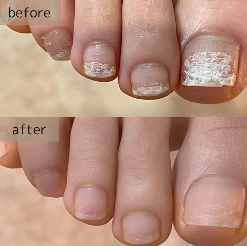 nail&footcare salon bloom(旧フットケアサロンRaffine)