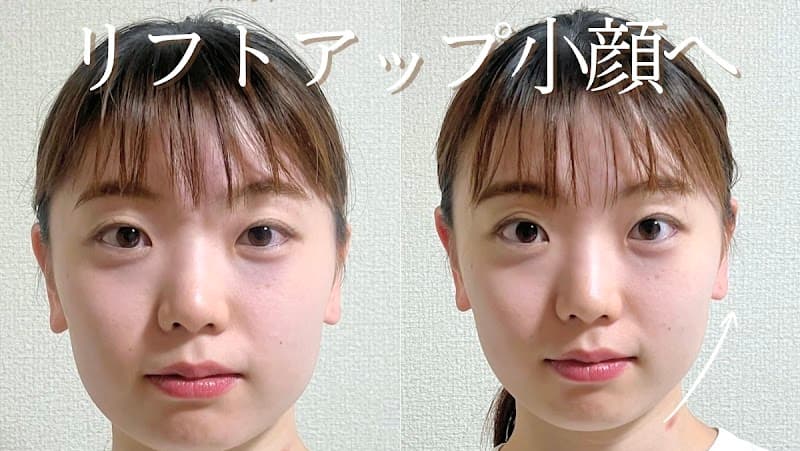 小顔矯正&毛穴洗浄 DREAM SPA 町田店
